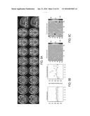 SYSTEMS AND METHODS FOR GENERATING BIOMARKERS BASED ON MULTIVARIATE     CLASSIFICATION OF FUNCTIONAL IMAGING AND ASSOCIATED DATA diagram and image