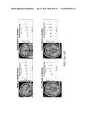 SYSTEMS AND METHODS FOR GENERATING BIOMARKERS BASED ON MULTIVARIATE     CLASSIFICATION OF FUNCTIONAL IMAGING AND ASSOCIATED DATA diagram and image