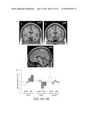 SYSTEMS AND METHODS FOR GENERATING BIOMARKERS BASED ON MULTIVARIATE     CLASSIFICATION OF FUNCTIONAL IMAGING AND ASSOCIATED DATA diagram and image