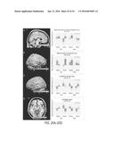 SYSTEMS AND METHODS FOR GENERATING BIOMARKERS BASED ON MULTIVARIATE     CLASSIFICATION OF FUNCTIONAL IMAGING AND ASSOCIATED DATA diagram and image