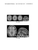 SYSTEMS AND METHODS FOR GENERATING BIOMARKERS BASED ON MULTIVARIATE     CLASSIFICATION OF FUNCTIONAL IMAGING AND ASSOCIATED DATA diagram and image