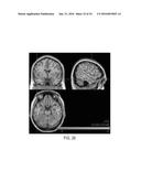 SYSTEMS AND METHODS FOR GENERATING BIOMARKERS BASED ON MULTIVARIATE     CLASSIFICATION OF FUNCTIONAL IMAGING AND ASSOCIATED DATA diagram and image