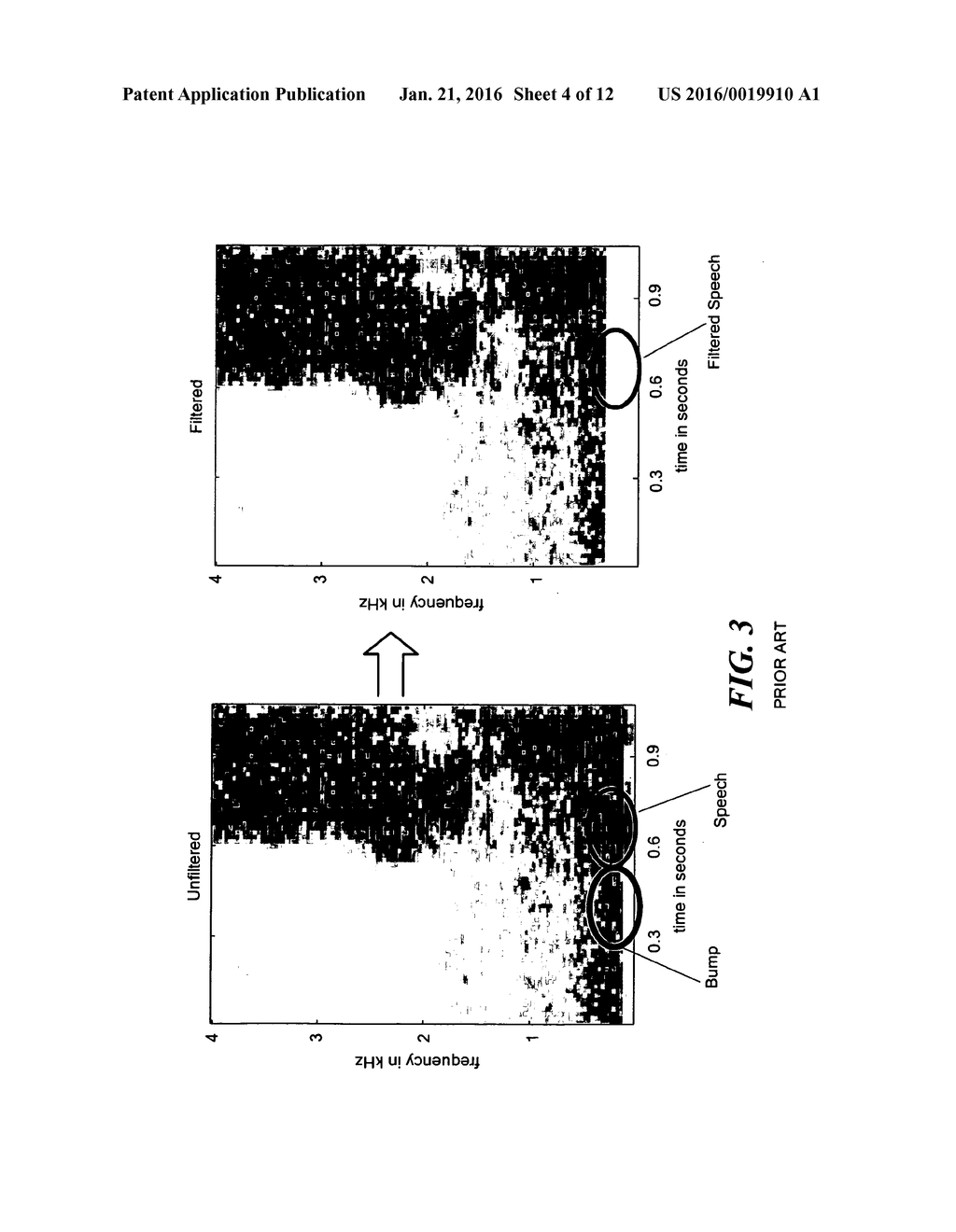 Methods and Apparatus for Dynamic Low Frequency Noise Suppression - diagram, schematic, and image 05