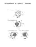 APPARATUS, SYSTEM AND METHODS FOR MEASURING A BLOOD PRESSURE GRADIENT diagram and image