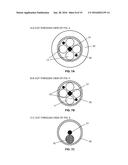 APPARATUS, SYSTEM AND METHODS FOR MEASURING A BLOOD PRESSURE GRADIENT diagram and image