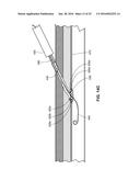 TISSUE AND VASCULAR CLOSURE DEVICES AND METHODS OF USE THEREOF diagram and image