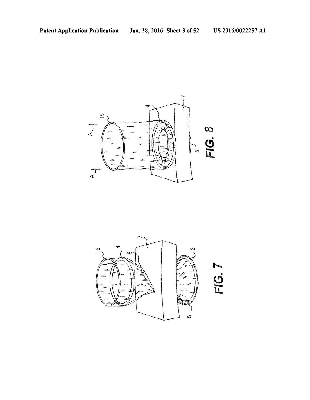 WOUND RETRACTOR DEVICE - diagram, schematic, and image 04