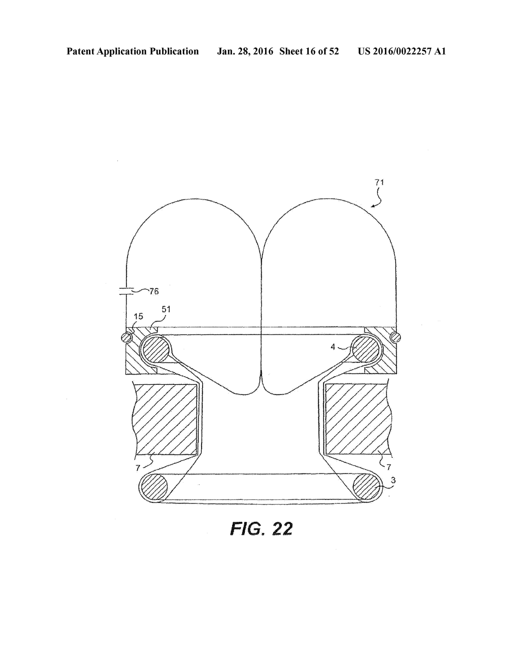 WOUND RETRACTOR DEVICE - diagram, schematic, and image 17