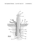 KNOTLESS SUTURE ANCHOR AND METHOD OF USING SAME diagram and image