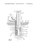 KNOTLESS SUTURE ANCHOR AND METHOD OF USING SAME diagram and image