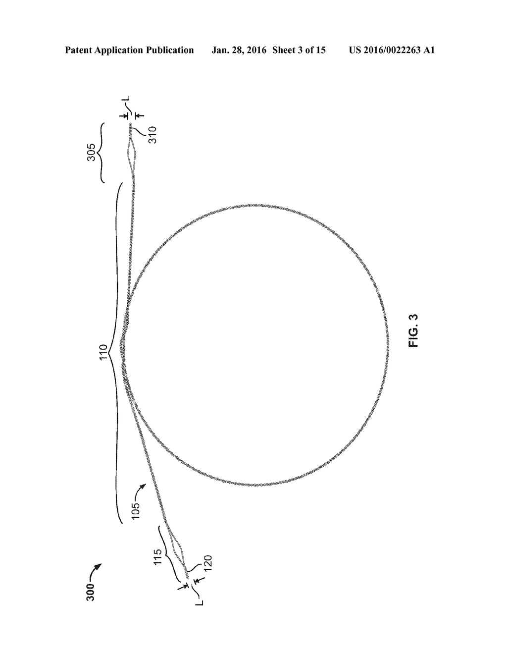 SHAPE MEMORY FILAMENT FOR SUTURE MANAGEMENT - diagram, schematic, and image 04