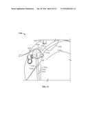 SHAPE MEMORY FILAMENT FOR SUTURE MANAGEMENT diagram and image