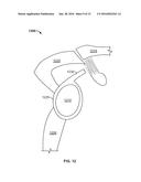 SHAPE MEMORY FILAMENT FOR SUTURE MANAGEMENT diagram and image