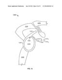 SHAPE MEMORY FILAMENT FOR SUTURE MANAGEMENT diagram and image