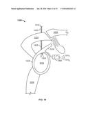 SHAPE MEMORY FILAMENT FOR SUTURE MANAGEMENT diagram and image