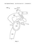 SHAPE MEMORY FILAMENT FOR SUTURE MANAGEMENT diagram and image