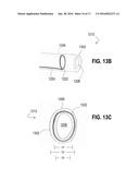 DEVICES, SYSTEMS, AND METHODS FOR INVERTING AND CLOSING THE LEFT ATRIAL     APPENDAGE diagram and image