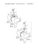 SPINAL MARKER SYSTEM AND METHODS OF USE diagram and image