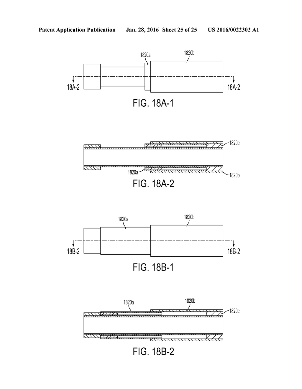 LEAD EXTRACTION METHODS AND APPARATUS - diagram, schematic, and image 26