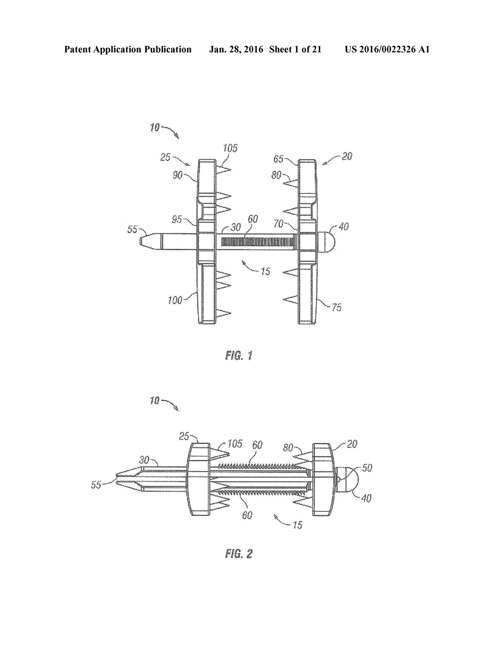 SPINOUS PROCESS FUSION DEVICES - diagram, schematic, and image 02