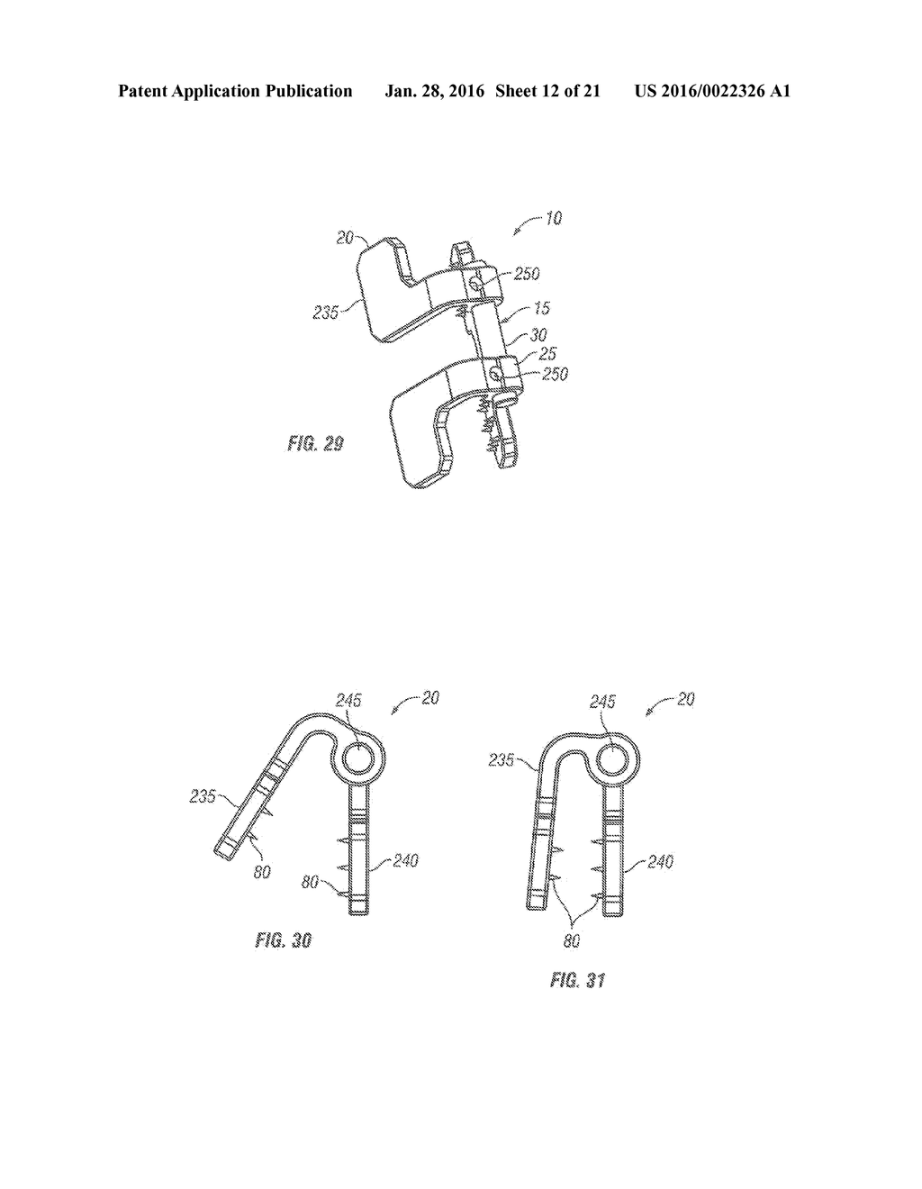 SPINOUS PROCESS FUSION DEVICES - diagram, schematic, and image 13