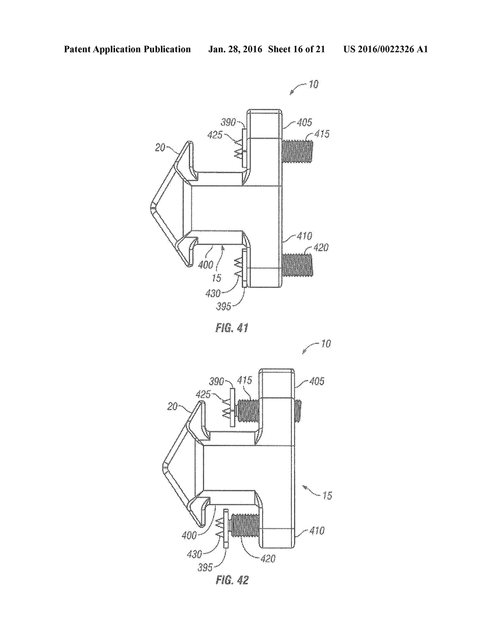 SPINOUS PROCESS FUSION DEVICES - diagram, schematic, and image 17