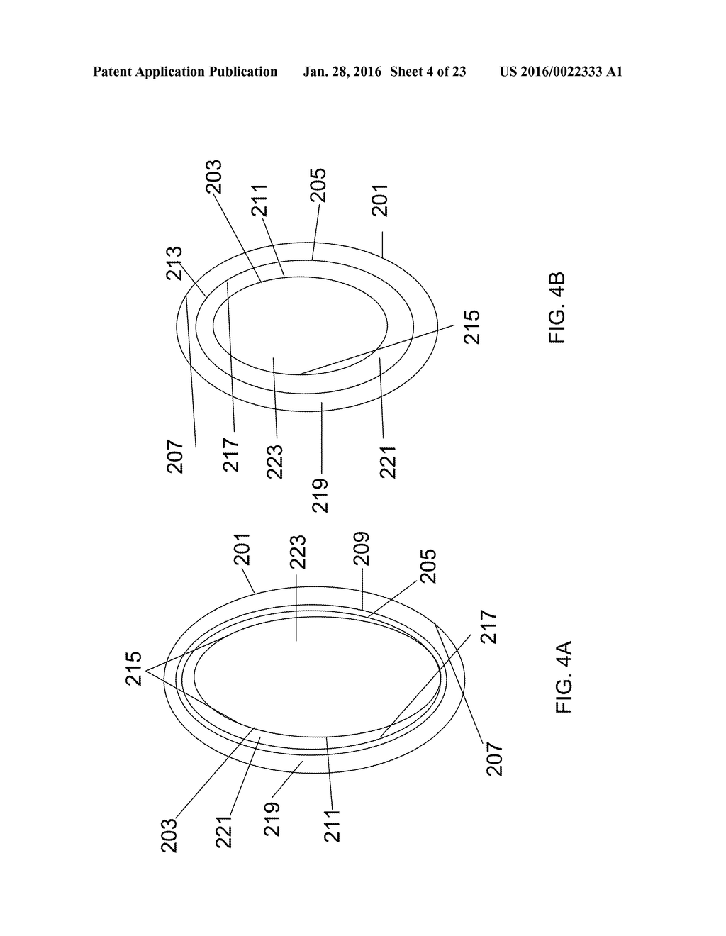 SYSTEMS AND METHODS FOR TREATING CONDITIONS AND DISEASES OF THE SPINE - diagram, schematic, and image 05