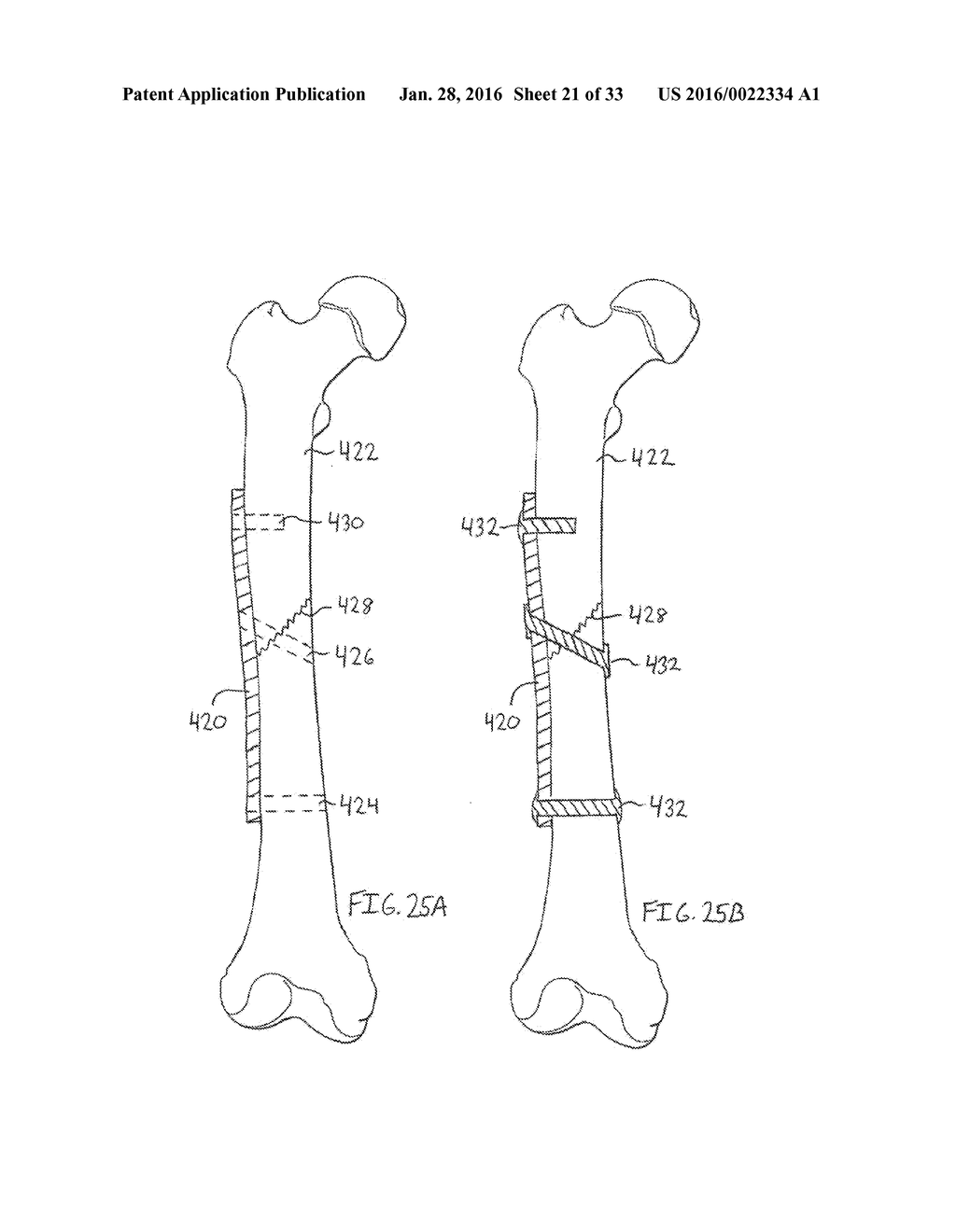 METHODS AND DEVICES FOR TRAUMA WELDING - diagram, schematic, and image 22