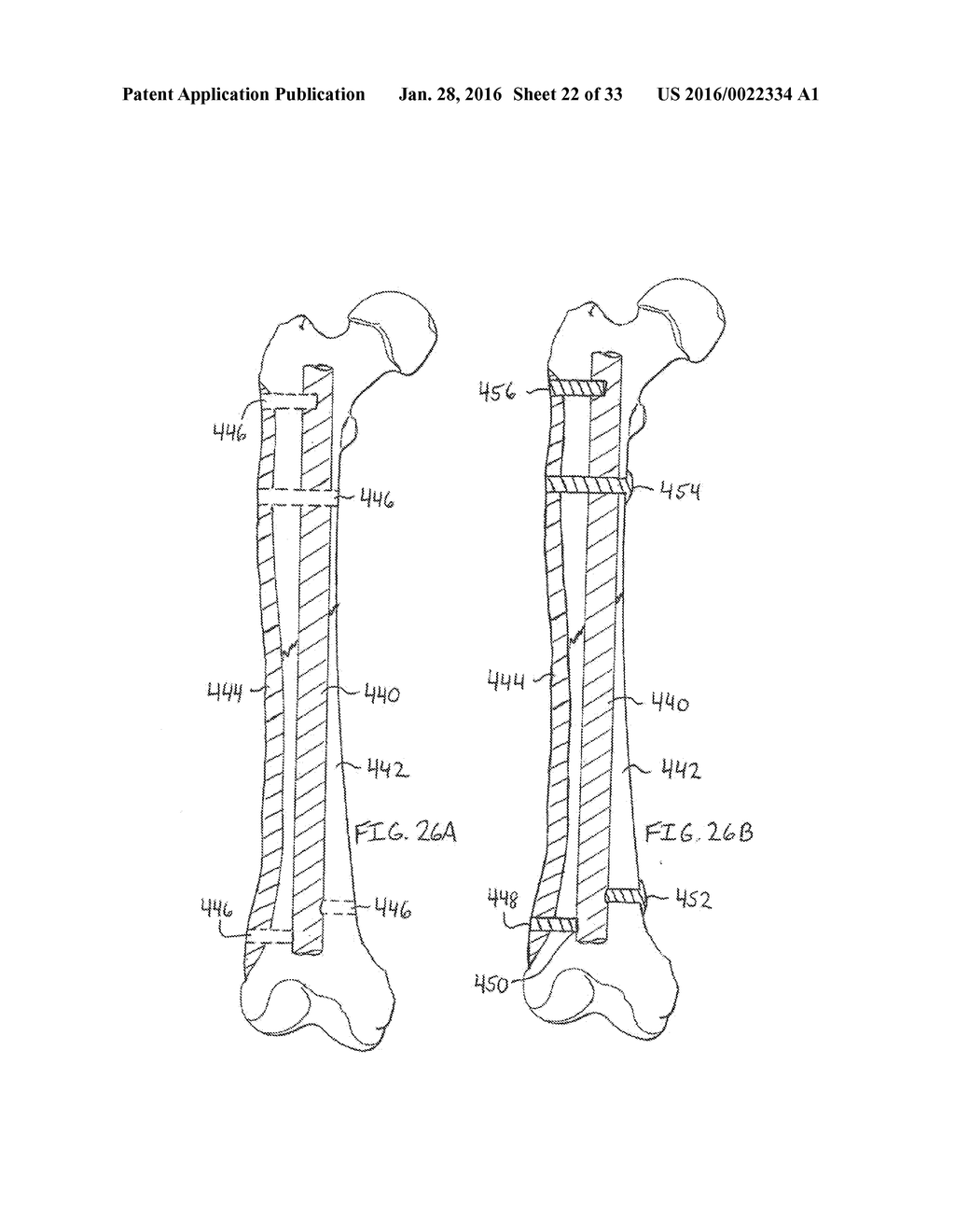 METHODS AND DEVICES FOR TRAUMA WELDING - diagram, schematic, and image 23