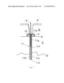 MEDICAL SCREW AND REMOVAL JIG FOR MEDICAL SCREW diagram and image