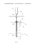 MEDICAL SCREW AND REMOVAL JIG FOR MEDICAL SCREW diagram and image