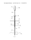 MEDICAL SCREW AND REMOVAL JIG FOR MEDICAL SCREW diagram and image