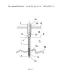 MEDICAL SCREW AND REMOVAL JIG FOR MEDICAL SCREW diagram and image