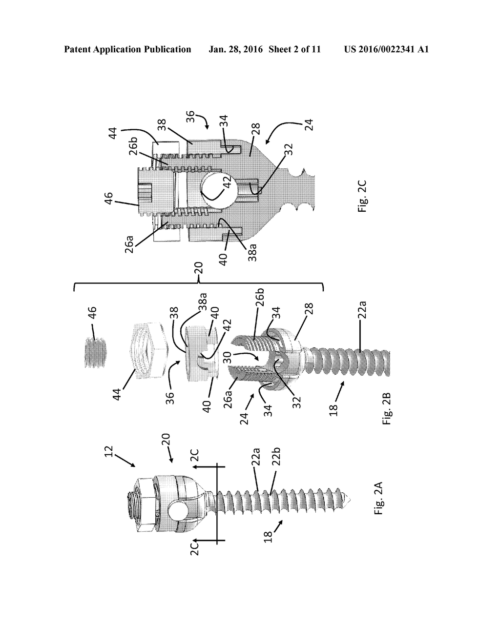 Pedicle Screw Assembly - diagram, schematic, and image 03