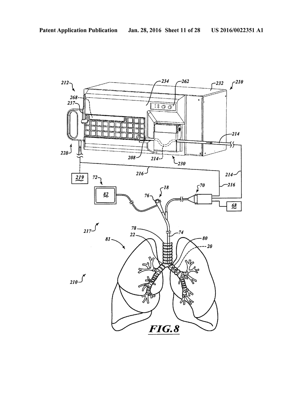 FLUID DELIVERY SYSTEM AND METHOD FOR TREATMENT - diagram, schematic, and image 12