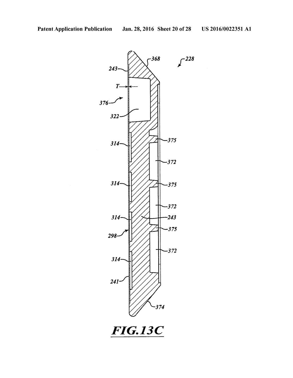 FLUID DELIVERY SYSTEM AND METHOD FOR TREATMENT - diagram, schematic, and image 21