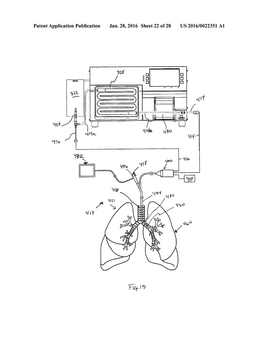 FLUID DELIVERY SYSTEM AND METHOD FOR TREATMENT - diagram, schematic, and image 23