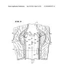 METHOD FOR TREATING FECAL INCONTINENCE diagram and image