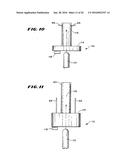 METHOD FOR TREATING FECAL INCONTINENCE diagram and image