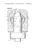 METHOD FOR TREATING FECAL INCONTINENCE diagram and image