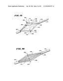 METHOD FOR TREATING FECAL INCONTINENCE diagram and image