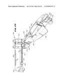 METHOD FOR TREATING FECAL INCONTINENCE diagram and image