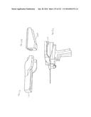 ON-BOARD TOOL TRACKING SYSTEM AND METHODS OF COMPUTER ASSISTED SURGERY diagram and image