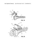 ON-BOARD TOOL TRACKING SYSTEM AND METHODS OF COMPUTER ASSISTED SURGERY diagram and image