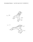 ON-BOARD TOOL TRACKING SYSTEM AND METHODS OF COMPUTER ASSISTED SURGERY diagram and image