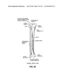 ON-BOARD TOOL TRACKING SYSTEM AND METHODS OF COMPUTER ASSISTED SURGERY diagram and image