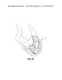 ON-BOARD TOOL TRACKING SYSTEM AND METHODS OF COMPUTER ASSISTED SURGERY diagram and image