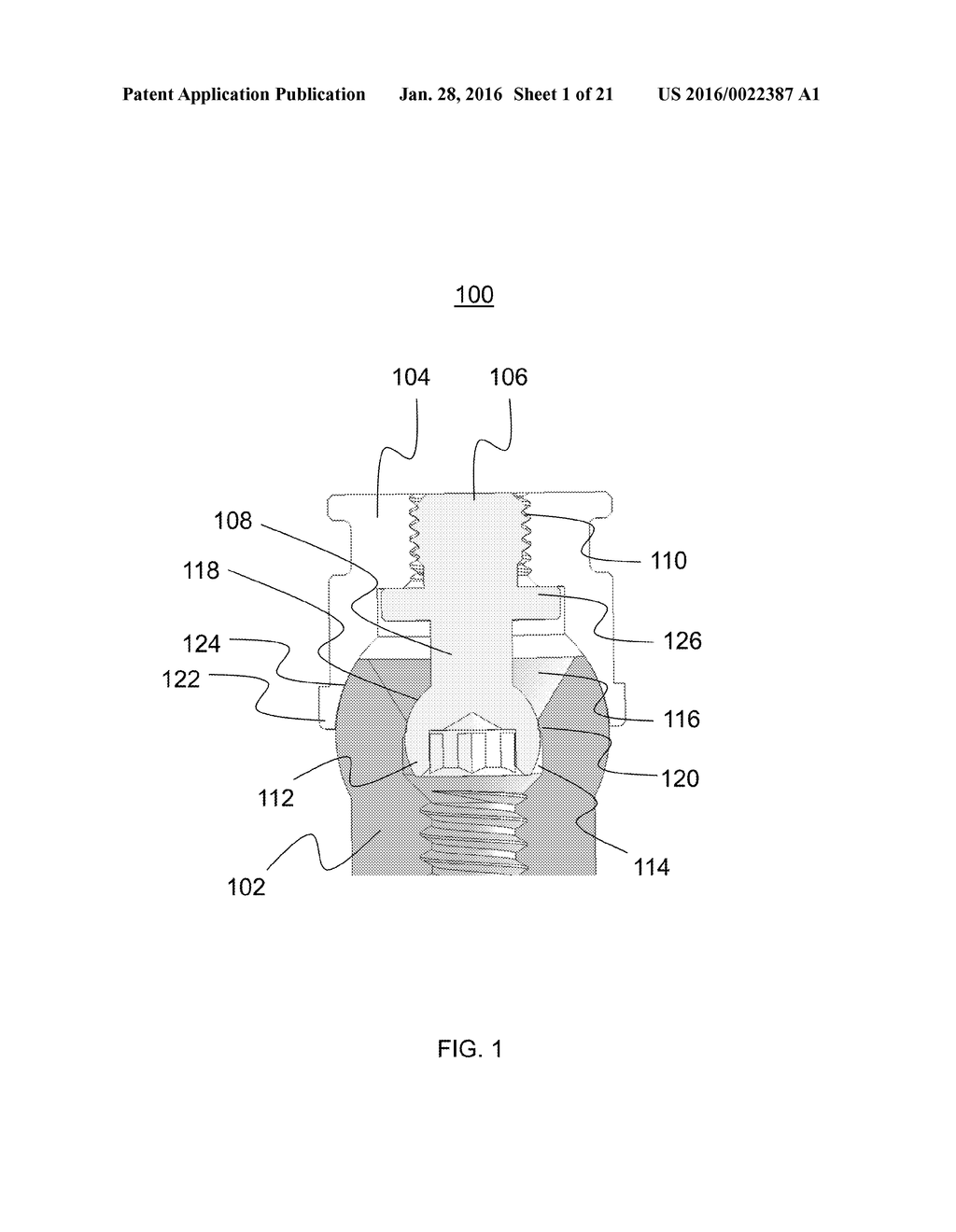 FIXED HYBRID DENTAL ATTACHMENT DEVICE AND METHODS OF USE - diagram, schematic, and image 02