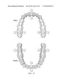 FASTENABLE DEVICE FOR ORAL CAVITY POSITION DETECTION diagram and image