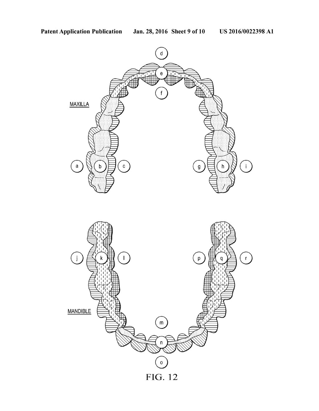 FASTENABLE DEVICE FOR ORAL CAVITY POSITION DETECTION - diagram, schematic, and image 10